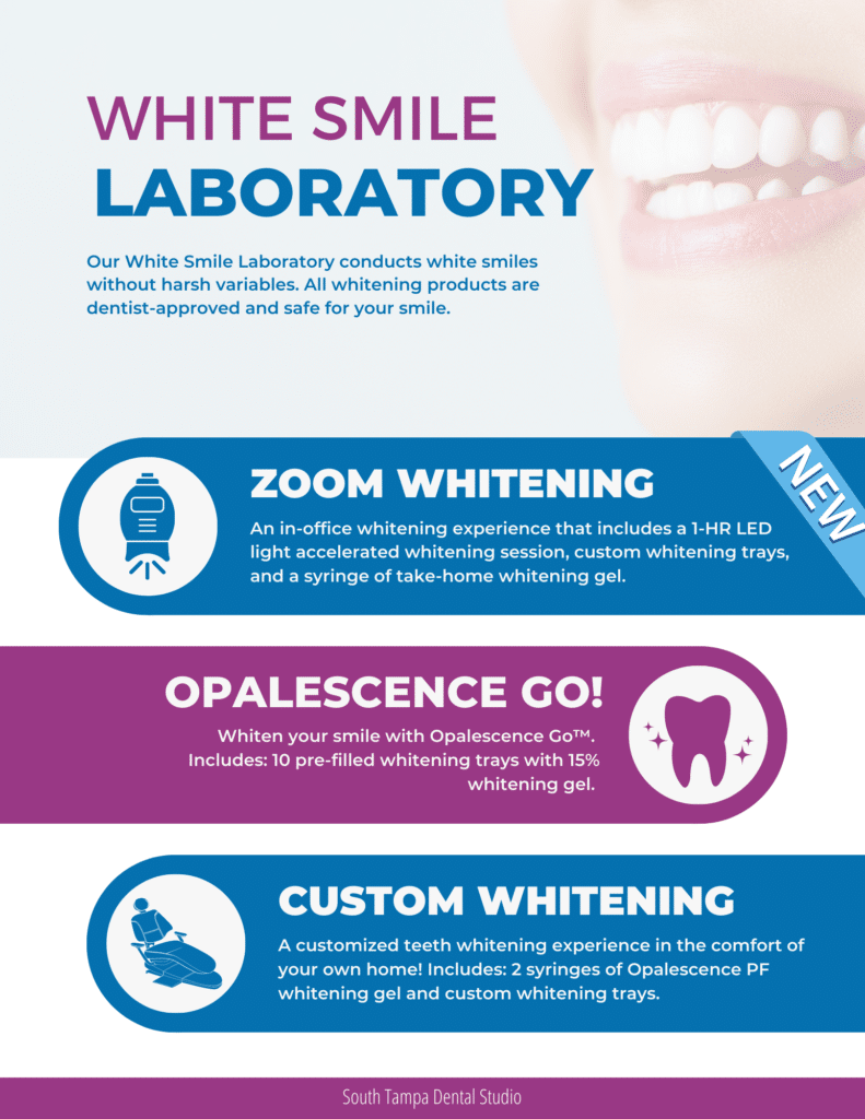 Teeth-Whitening-Services